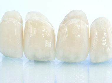 04 義歯・かぶせ物に強い技術体制